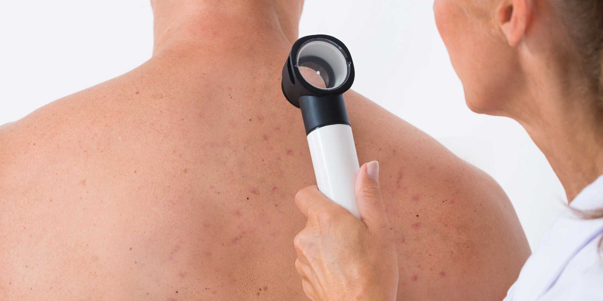 ¿Por qué ver un dermatólogo certificado?